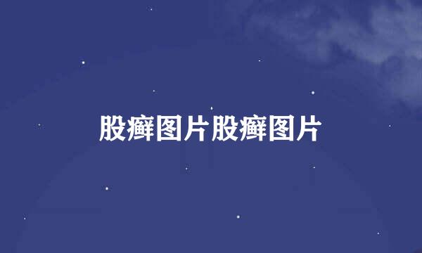 股癣图片股癣图片