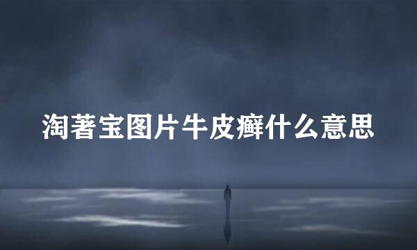 淘著宝图片牛皮癣什么意思