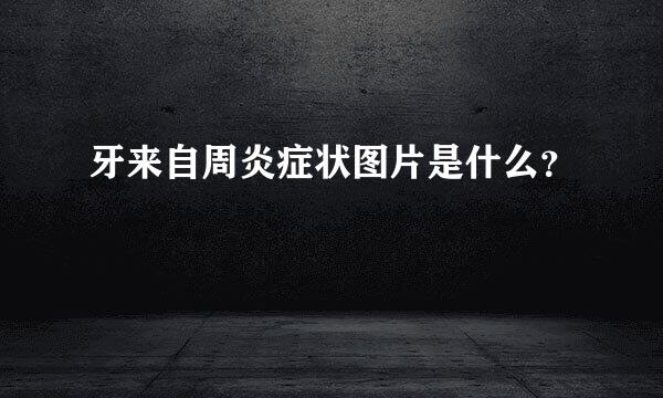 牙来自周炎症状图片是什么？