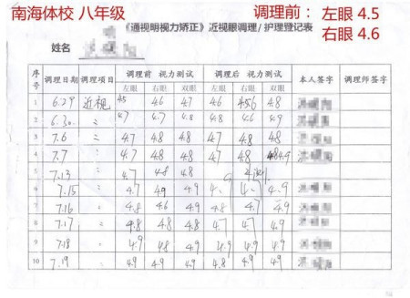 真性近视能治好吗