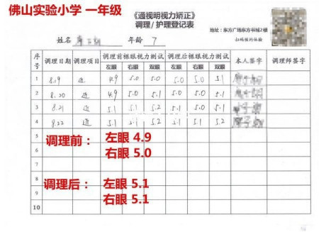 真性近视能治好吗
