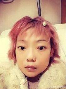 名模伍智恒八年内切割肠胃，全身瘫痪如怪物，如今又怎样了？