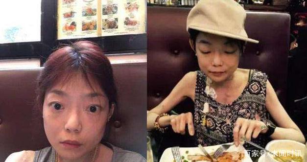名模伍智恒八年内切割肠胃，全身瘫痪如怪物，如今又怎样了？