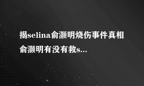 揭selina俞灏明烧伤事件真相 俞灏明有没有救selina