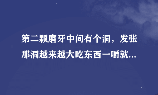 第二颗磨牙中间有个洞，发张那洞越来越大吃东西一嚼就痛已经有半年多了，半年一直都是都是这样，