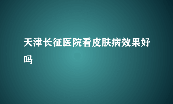 天津长征医院看皮肤病效果好吗