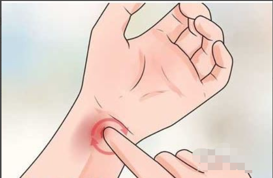 脸上的淤青怎么快速消除？