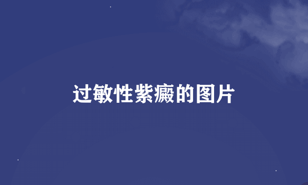 过敏性紫癜的图片