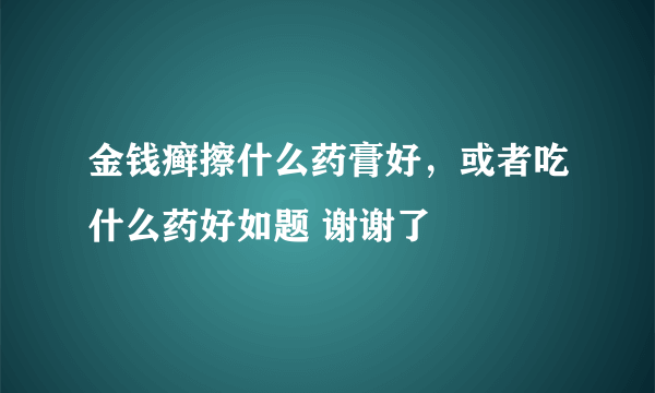 金钱癣擦什么药膏好，或者吃什么药好如题 谢谢了