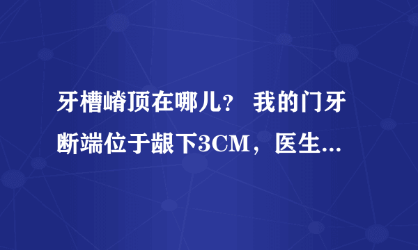 牙槽嵴顶在哪儿？ 我的门牙断端位于龈下3CM，医生帮我切除了部分牙龈，当天就做了纤维桩没有去牙槽骨。